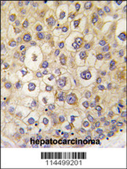 ARHE Antibody (Center)