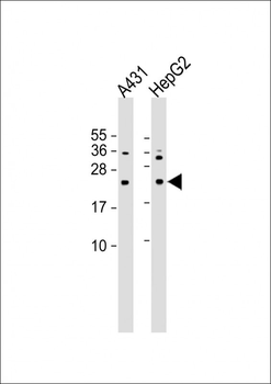 NRAS Antibody (N-term)