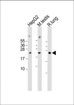 NRAS Antibody (N-term)