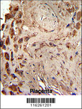 PRKRA Antibody (S246)