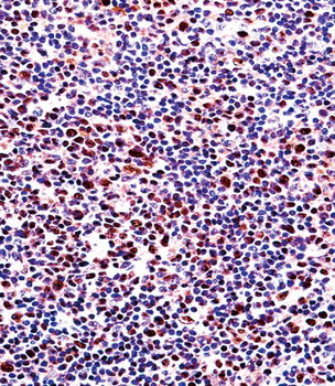 RUNX2 Antibody (S533)