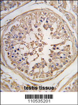 PUM1 Antibody (N-term)