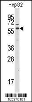 GRK7 Antibody (C-term)