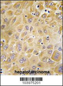 GRK7 Antibody (C-term)