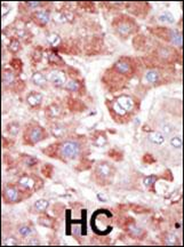 GRK7 Antibody (C-term)