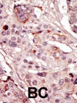 SRMS Antibody (N-term)