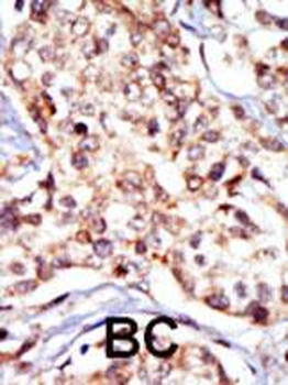 SRC Antibody (N-term)