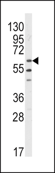 LYN Antibody (N-term)