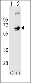 FYN Antibody (N-term)