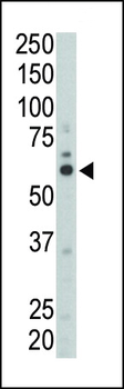 FYN Antibody (N-term)