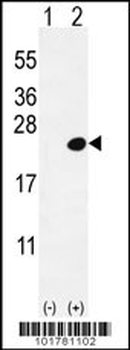 DOK5 Antibody (C-term)