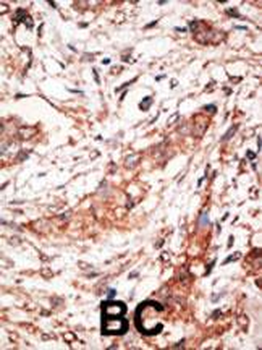 DOK4 Antibody (C-term)
