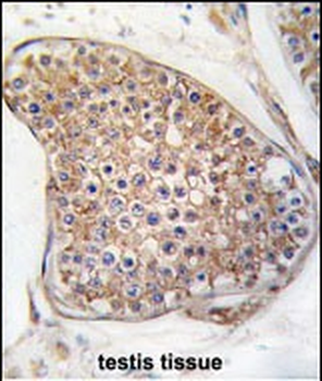 TEK (TIE2) Antibody (C-term)