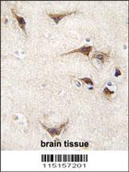 TYRO3 Antibody