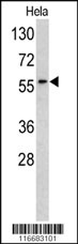 RYK Antibody (Center C397)