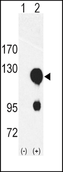ROR2 Antibody (N-term)