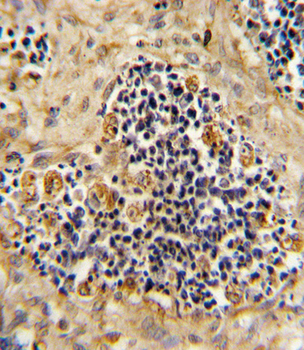 ROR2 Antibody (N-term)