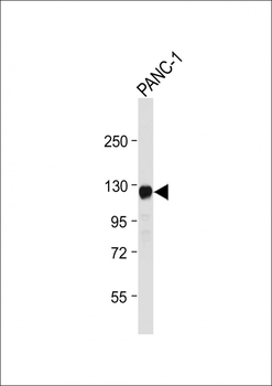 ROR1 Antibody
