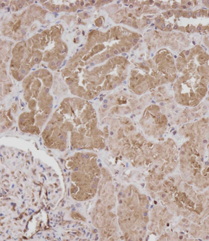 ROR1 Antibody
