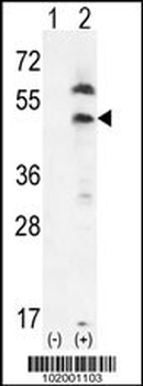 PDGFRL Antibody (C-term)