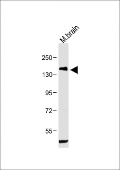 PDGFRA Antibody