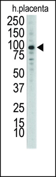 DDR1 Antibody (N-term)