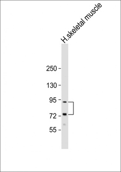LTK Antibody (N-term)