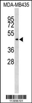 ILK Antibody (S343)