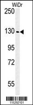 IGF1R Antibody (N-term K66)