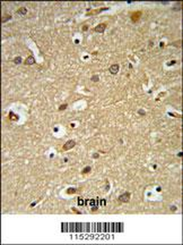 IGF1R Antibody (N-term K66)