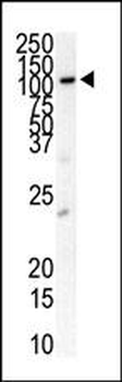 FLT3 (CD135) Antibody (N-term)