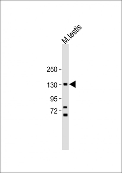FLT3 (CD135) Antibody (N-term)