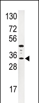 IGFBP3 Antibody (N-term)