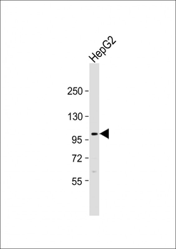 FGFR4 Antibody (N-term)