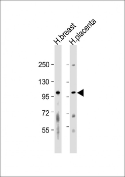 FGFR2 Antibody (N-term R22)