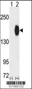 ErbB2 (C-term) Antibody