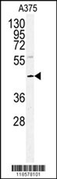 POLDIP2 Antibody (Center)