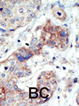 EphB3 Antibody (N-term)
