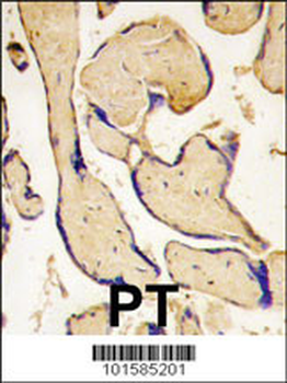 EphA3 Antibody (C-term)