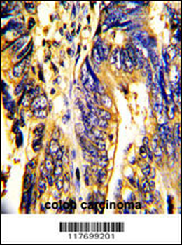 AXL Antibody