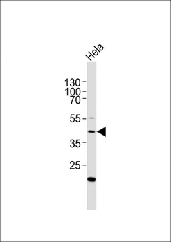 E2F1 Antibody (H357)