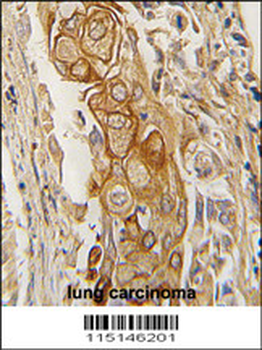 ACPP Antibody (C-term)