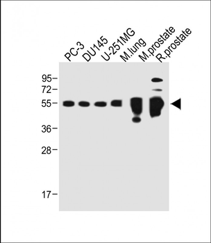 ACPP Antibody (C-term)