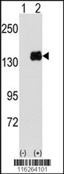 PUM1 Antibody (Y83)