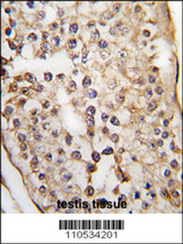 PUM2 Antibody (N-term)