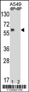 BBS4 Antibody (Center)
