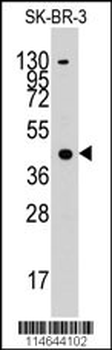 ACAT1 Antibody (C-term)