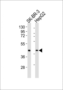 ACAT1 Antibody (C-term)