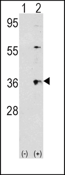 Thrombopoietin (TPO) Antibody (Center)