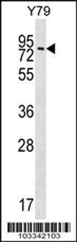 MAK Antibody (C-term)